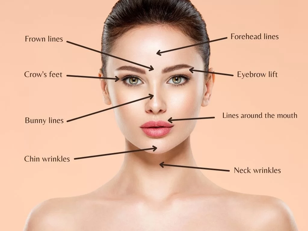 Anti aging treatment/lip fillers/anti wrinkle injections